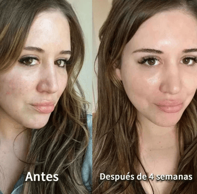Mascarillas de Colágeno Rejuvenece, Hidrata y Sana tu piel