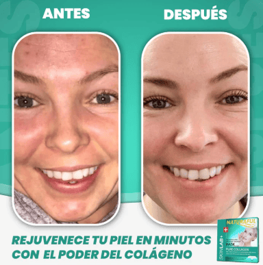 Mascarillas de Colágeno Rejuvenece, Hidrata y Sana tu piel