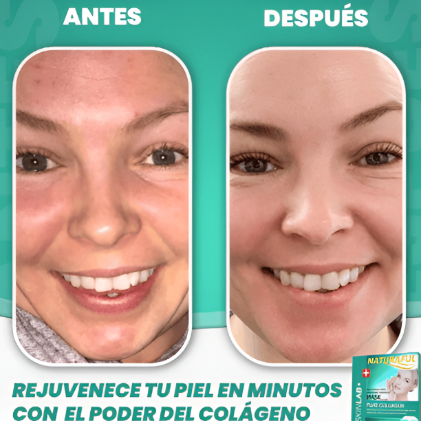 Mascarillas de Colágeno - Rejuvenece, Hidrata y Sana tu piel