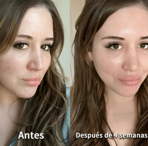 Mascarillas de Colágeno - Rejuvenece, Hidrata y Sana tu piel