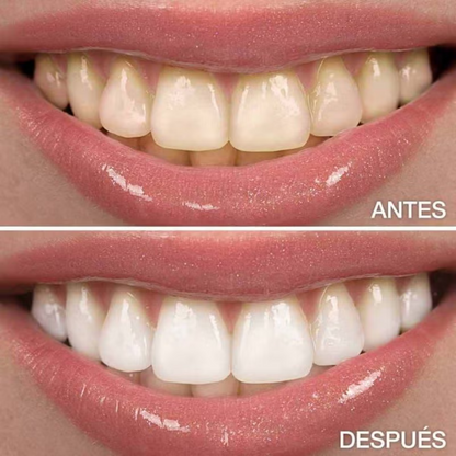 Blanqueador Dental de Carbón Natural - Blanqueo en solo 2 minutos