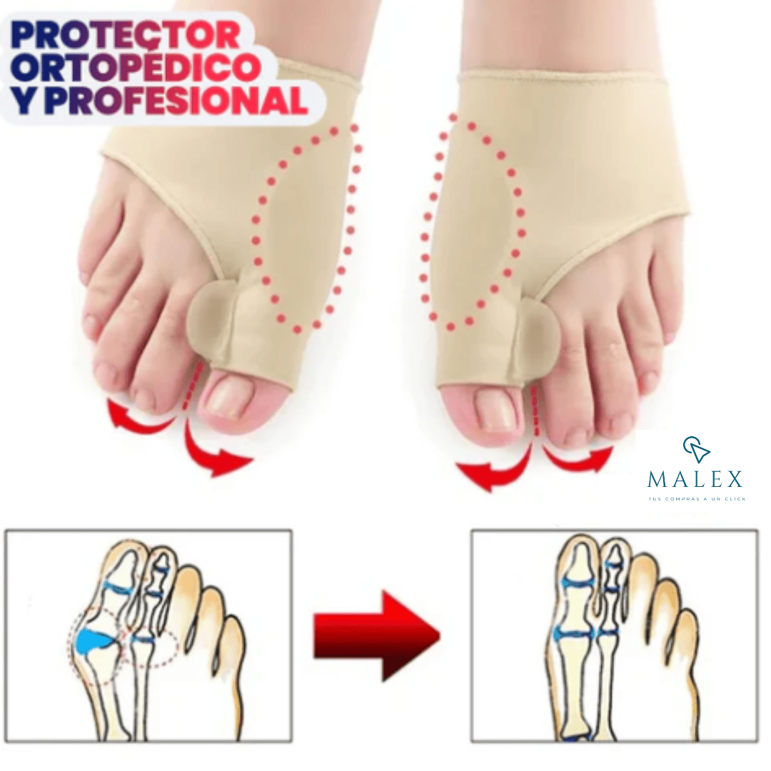 CORRECTOR DE JUANETES 2x1 | ELIMINA ALIVIA Y PREVIENE EL DOLOR