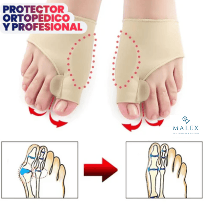 CORRECTOR DE JUANETES 2x1 | ELIMINA ALIVIA Y PREVIENE EL DOLOR