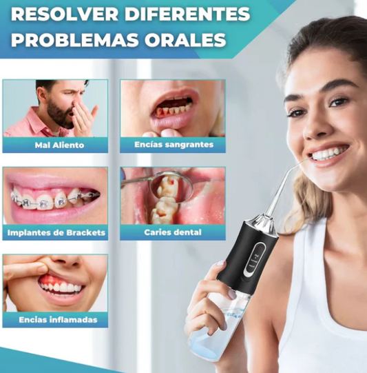 Irrigador para Limpieza Bucal ® - Cuida tus dientes y mejora tu sonrisa