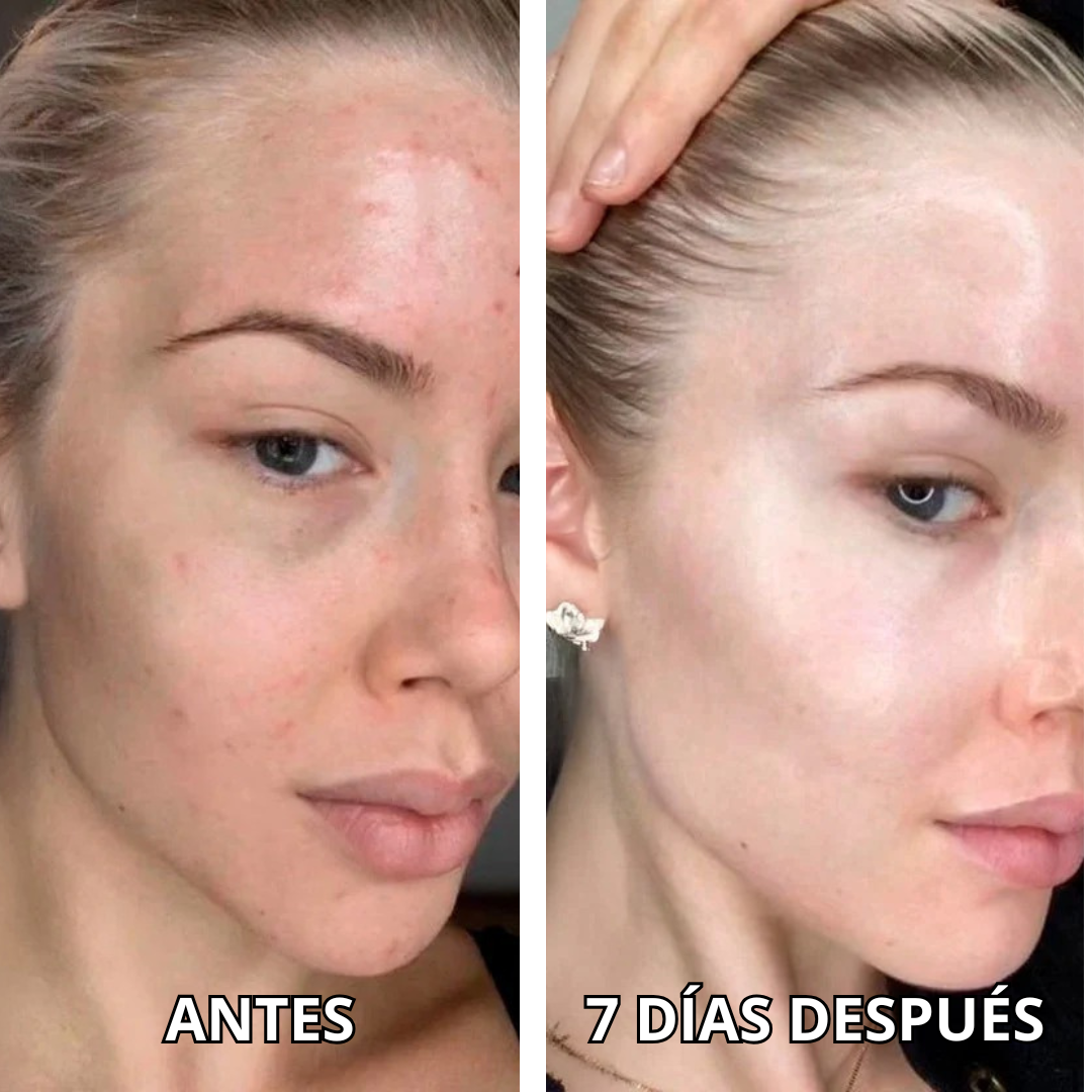 Mascarillas con Oro 24k - Rejuvenece, Hidrata y Elimina Arrugas