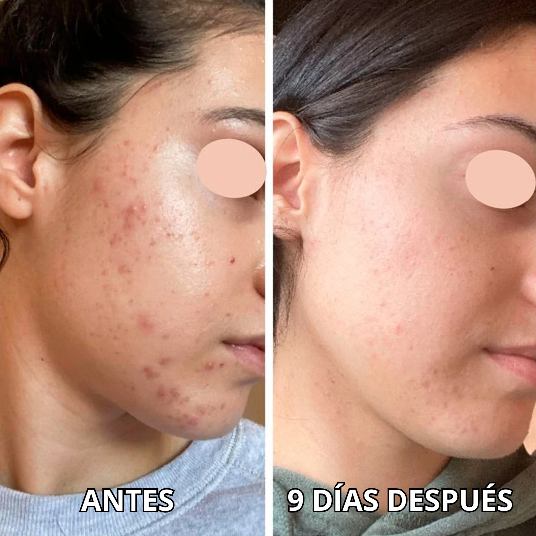 Mascarillas con Oro 24k - Rejuvenece, Hidrata y Elimina Arrugas