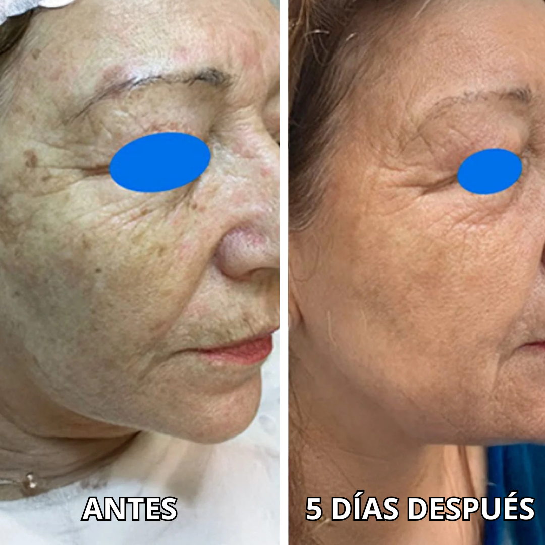 Mascarillas con Oro 24k - Rejuvenece, Hidrata y Elimina Arrugas
