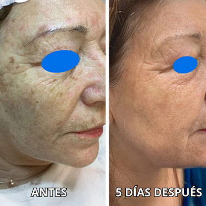 Mascarillas con Oro 24k - Rejuvenece, Hidrata y Elimina Arrugas